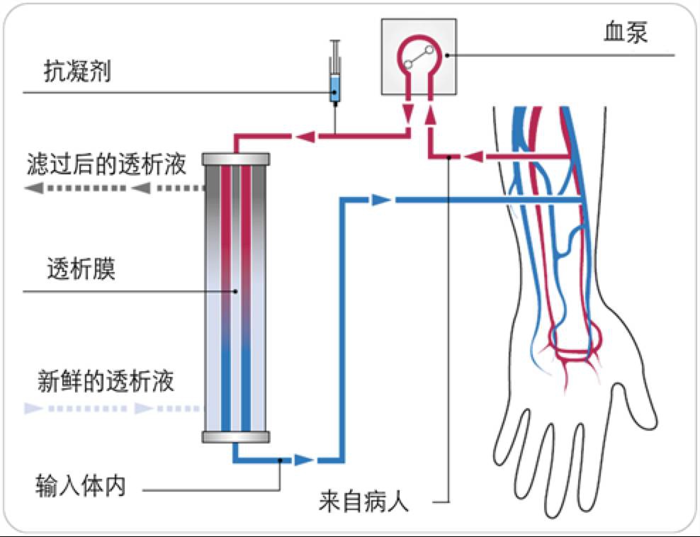 透析可怕吗？