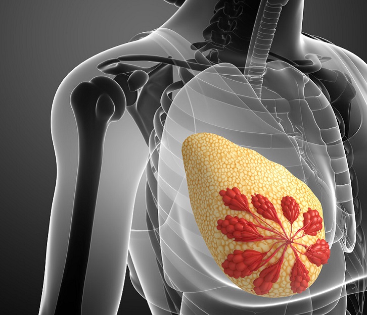 急性乳腺炎的健康指导