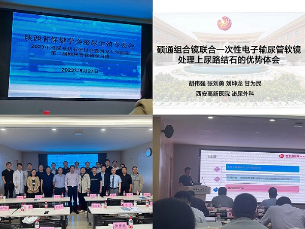 硕通镜联合一次性电子输尿管软镜处理上尿路结石优势