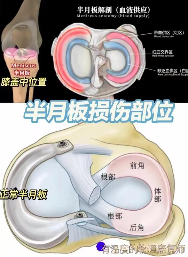 三个动作教你自测半月板是否受伤！