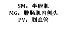 96532d650eb98e6e07832b10df35e8a.png
