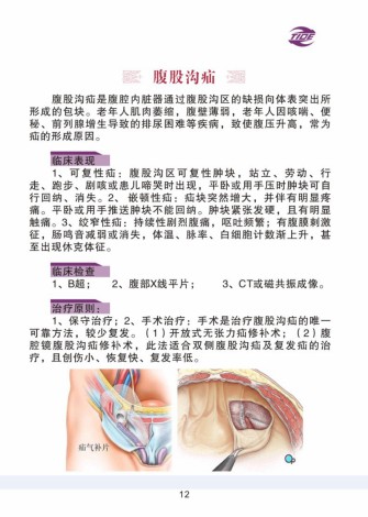 普外科加速康复外科手册_12.jpg