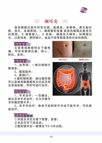 普外科加速康复外科手册_14.jpg