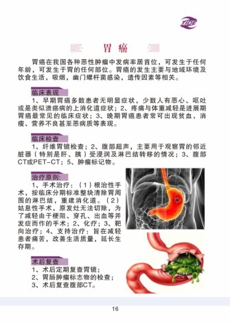 普外科加速康复外科手册_16.jpg