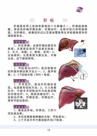 普外科加速康复外科手册_18.jpg
