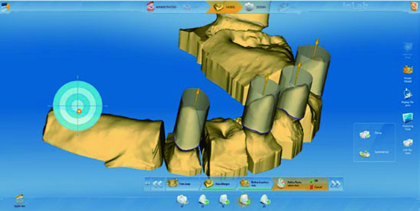 1564579745118268.jpg 3-1G20410491UL.jpg